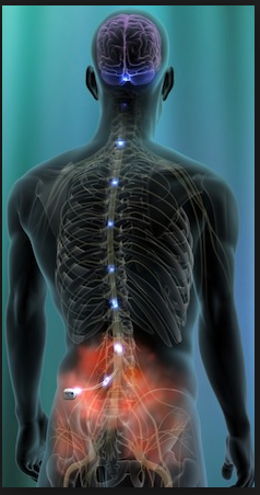 Peripheral Nerve Stimulator - Pain management clinics in Las Vegas